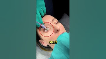 if you get super glue in your eyes 😱 #shorts