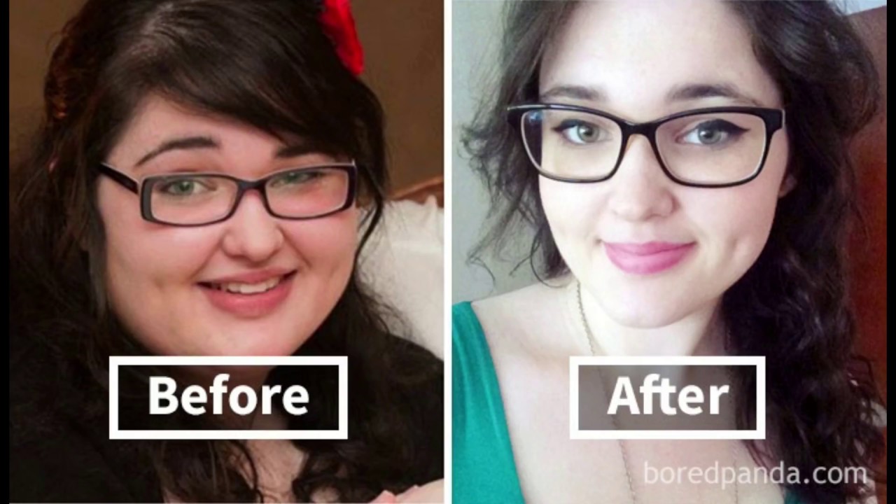 Amazing Before & After Pics Reveal How Weight Loss Affects Your Face