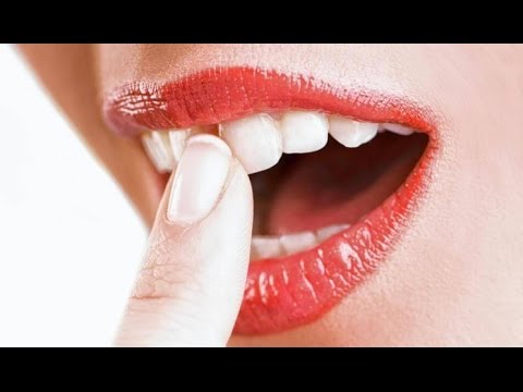 Video: Ինչ անել, եթե ատամի մի կտոր կոտրվի