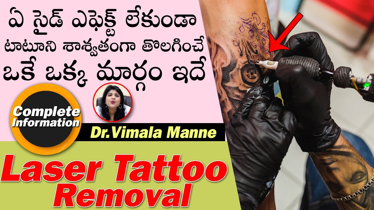 Discover 72+ tattoo removal cost in vizag best thtantai2
