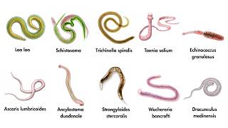 The Most Dangerous And Horrifying Parasitic Worms For Humans