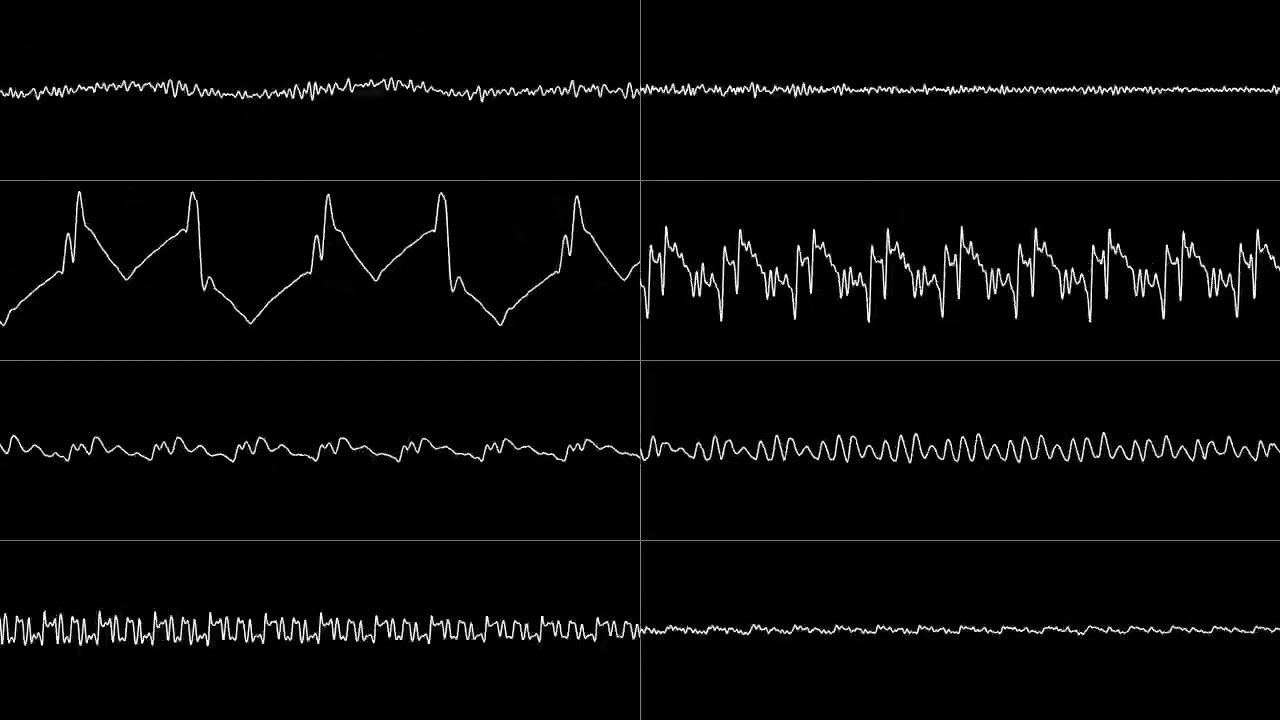 Psikhushka (SNES APU)