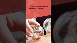 Cupping Therapy in Cypress TX