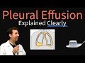Pleural Effusion Explained Clearly - Causes, Pathophysiology, Symptoms, Treatment,