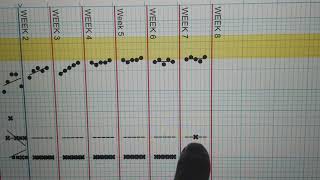 SAFMEDS cards and PrecisionX Chart