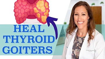 How to SHRINK Thyroid Nodules, Thyroid Cysts and Thyroid Goiters Naturally