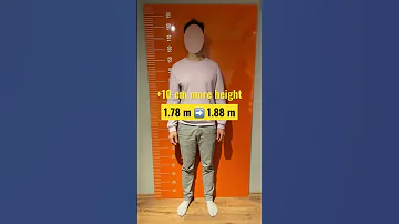 10cm More Height With Limb Lengthening Surgery Limblengthening Gettaller Beinverlängerung Short 