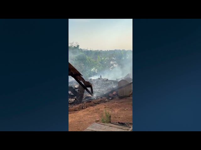 ADOLESCENTE SALVA IRMÃO DE INCÊNDIO E TEM 40% DO CORPO QUEIMADO