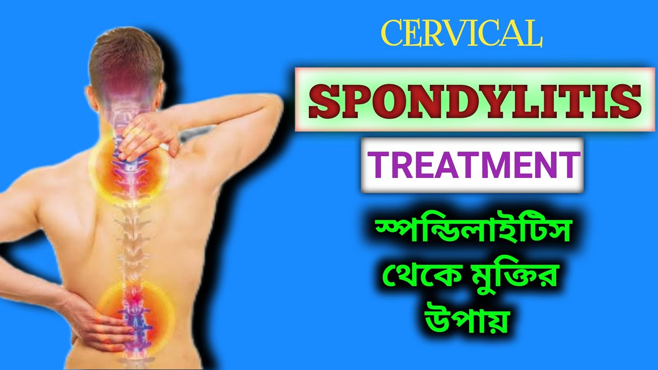 Homeopathic Medicine for Cervical Spondylosis | How to Treat Cervical ...