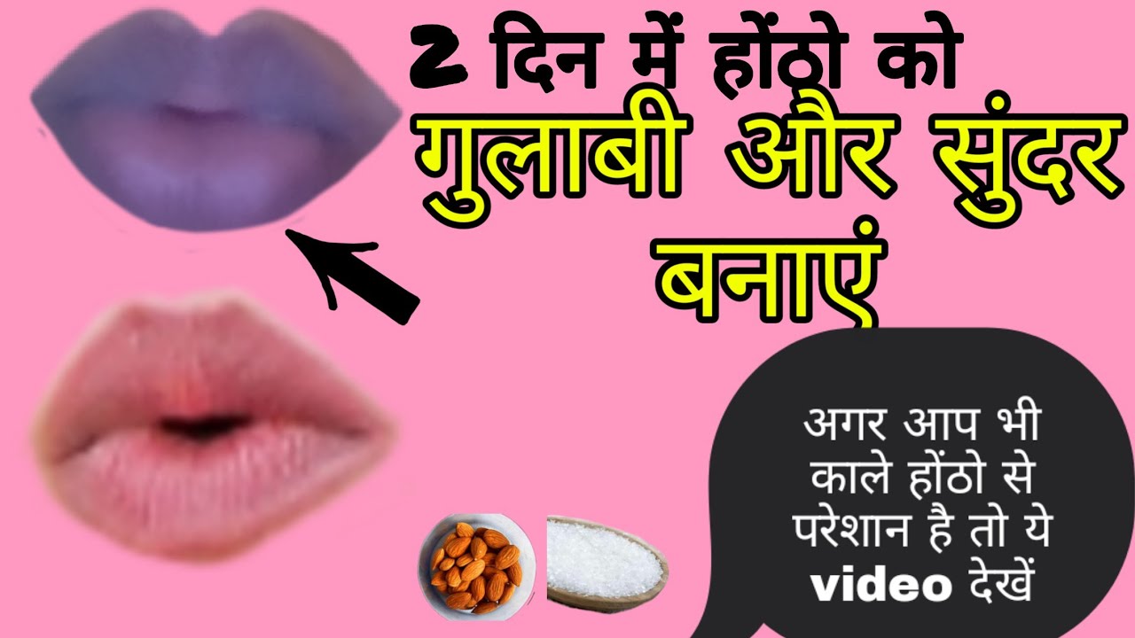 Kale Hoto Ko Pink Kaise Kare? How to lighten Dark Lips kale hoth