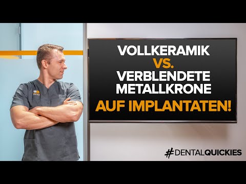 Video: Dentalveneers: Kosten, Verfahren Vs. Krone, Implantate Und Mehr