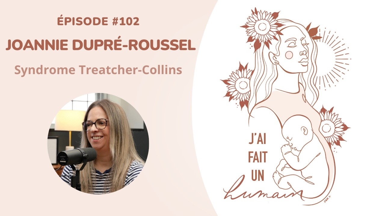 102-Joannie Dupré-Roussel: syndrome Treatcher-Collins