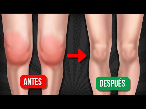 MASAJE para DESINFLAMAR LA RODILLA y eliminar el LÍQUIDO