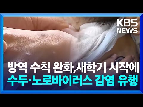 신학기 감염성 질환 주의…식중독, 수두 크게 유행 / KBS  2024.03.20.