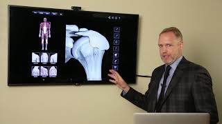 Traumatic Bursitis  Serious Accidents Can Affect Shoulder Movement