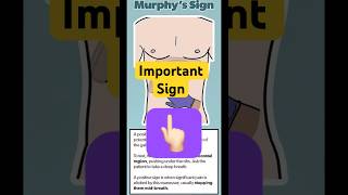 Murphy’s Sign, Bebinski Sign, Kernig’s Sign #kgmu #norcet10 #sgpgi #rml #importantmcqs #nursing