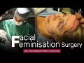 Live Facial Feminization Surgery | FFS  Surgery at Dr. Parag Telang ( Best Cosmetic Surgeon )