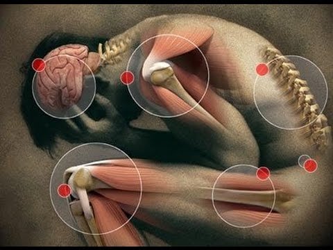 სხვადასხვა სახის ტკივილი | გამომწვევი მიზეზები და მისი მართვა