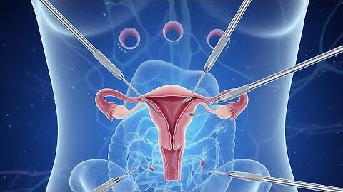 Robotic Hysterectomy