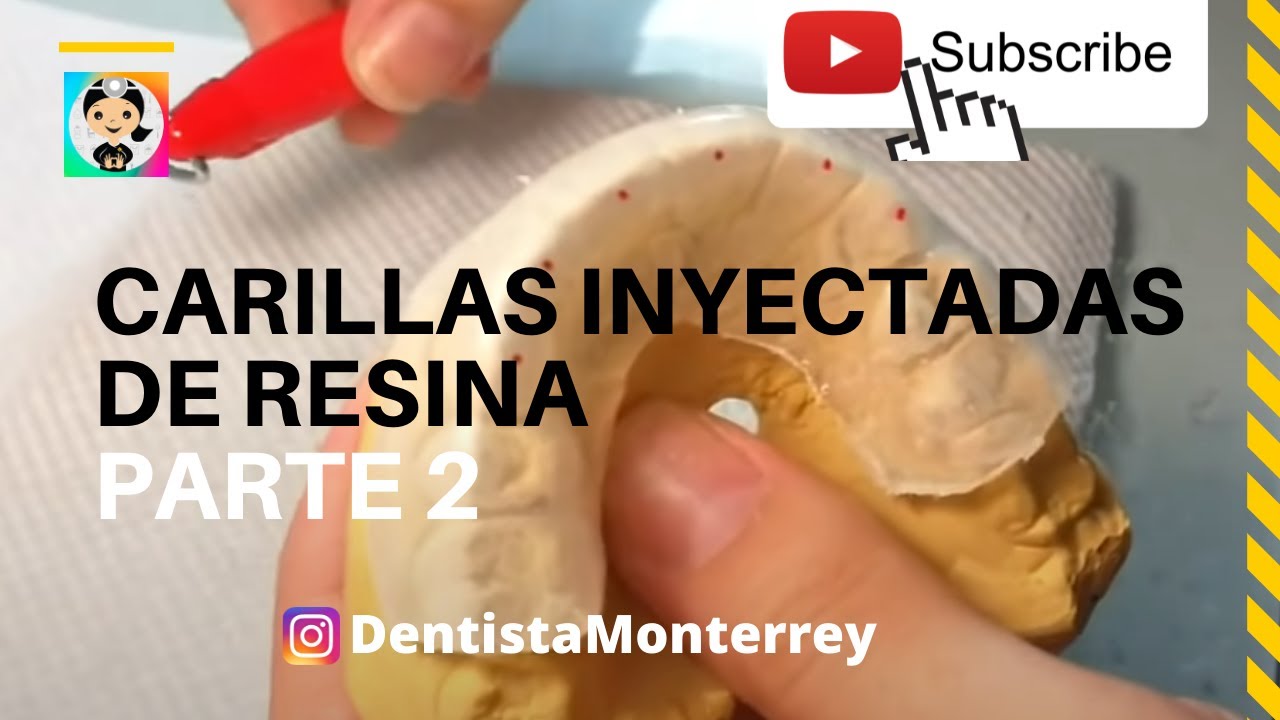CARILLAS DIRECTAS PASO a PASO👅Parte 2 LLAVE DE SILICÓN TRANSPARENTE #carillasderesina