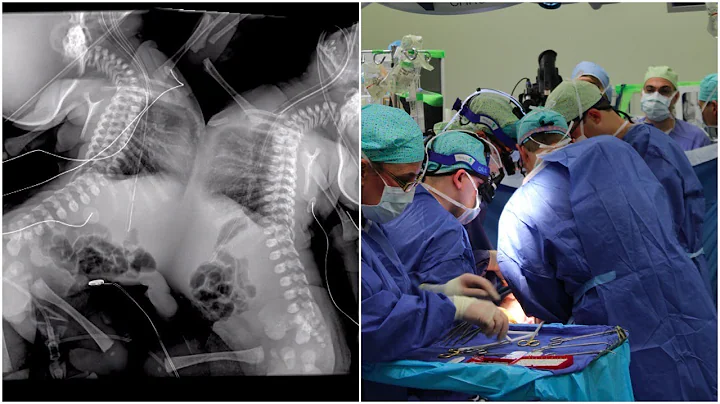 When Doctors Saw the Scan They Advised Her to Term...
