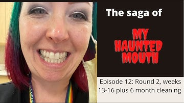 My Haunted Mouth, Episode 12: Weeks 13-16 of Invisalign Round 2