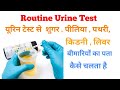 Urine routine test explain in hindi  urine test normal range