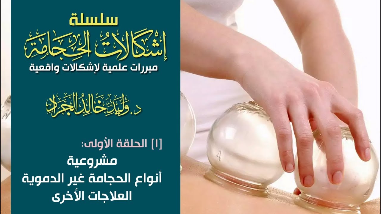 #سلسلة_إشكالات_الحجامة [1] مشروعية أنواع الحجامة غير الدموية والعلاجات الأخرى