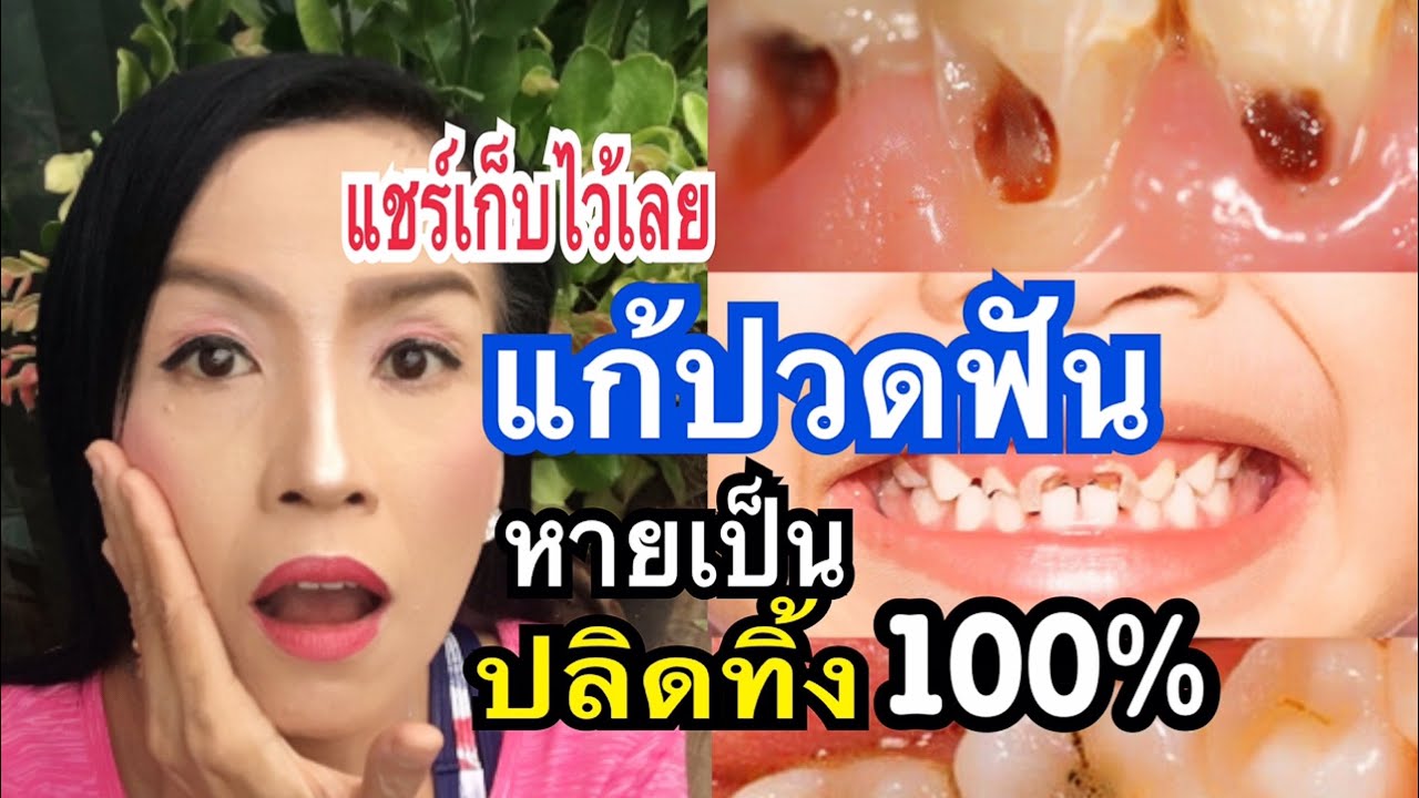 ยาสีฟัน แก้ปวดฟัน  Update 2022  ปวดฟันฟันผุฟันเป็นรูโพลงแมงกินเหงือกบวมกลิ่นปากแรงหายปวดฟันทันทีด้วยสิ่งนี้!!ทำครั้งเดียวแม่ก้อยพาทำ