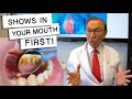 5 Diseases That Show Signs In Your Mouth