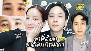 พาพี่อ๊อดมาศัลยกรรมที่เกาหลี ทำที่ไหน ปลอดภัยไหม บริการดีเปล่า? | Soundtiss