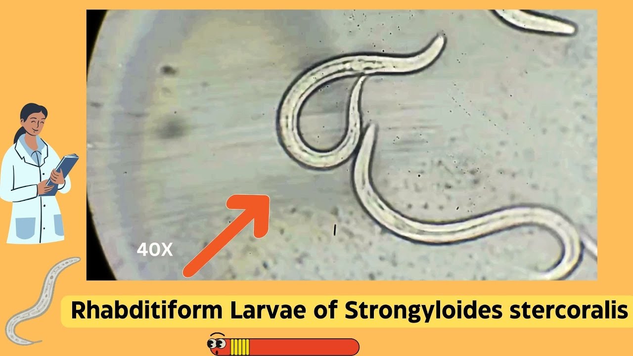 Understanding Strongyloides Rhabditiform Larvae: A Comprehensive Guide