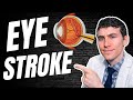 Eye stroke  retinal vein occlusion causes symptoms treatment