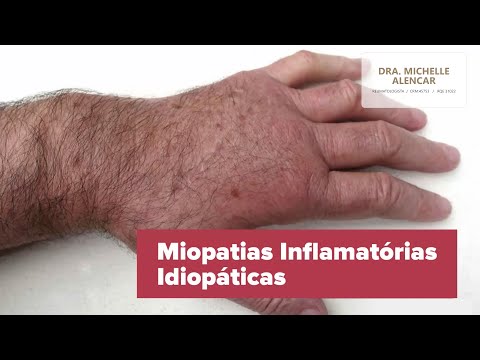 Vídeo: Doença Muscular Hereditária (miopatia Não Inflamatória) Em Labradores