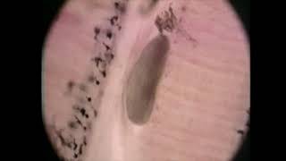 Ich Ichthyophthirius Multifiliis- Parasite Diseases In Trout - Signs, Identification, Treatment