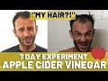 Apple Cider Vinegar Results For Hair Loss (7 DAYS!)