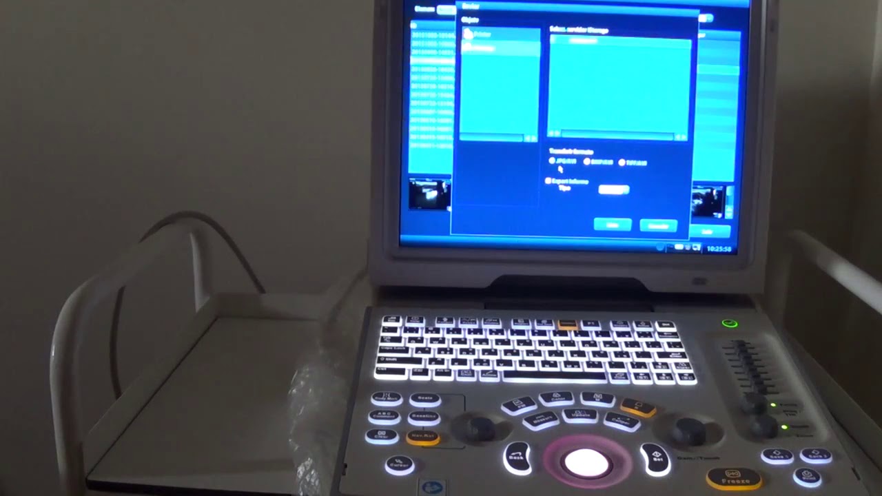 Guardar y exportar imágenes y videos en ecógrafo Mindray  Z6