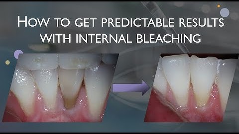 Dentists hate this one cool trick