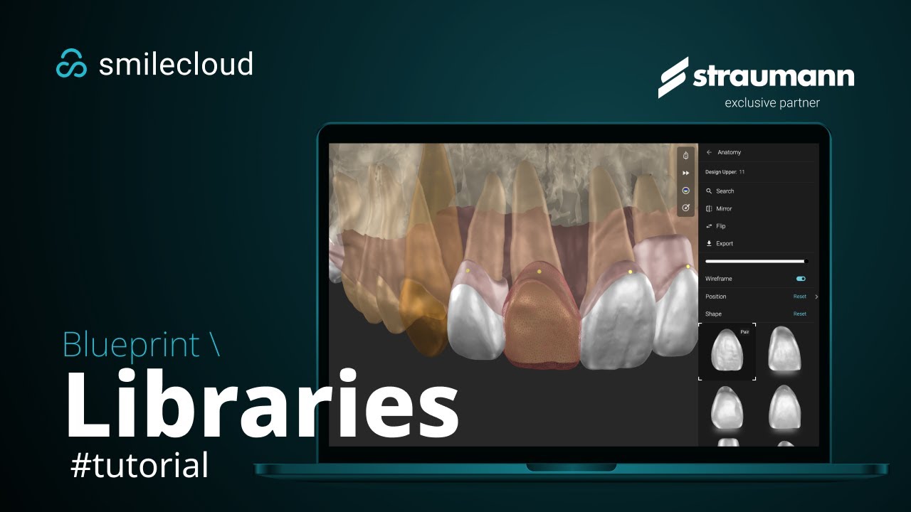 Blueprint - Library Controls
