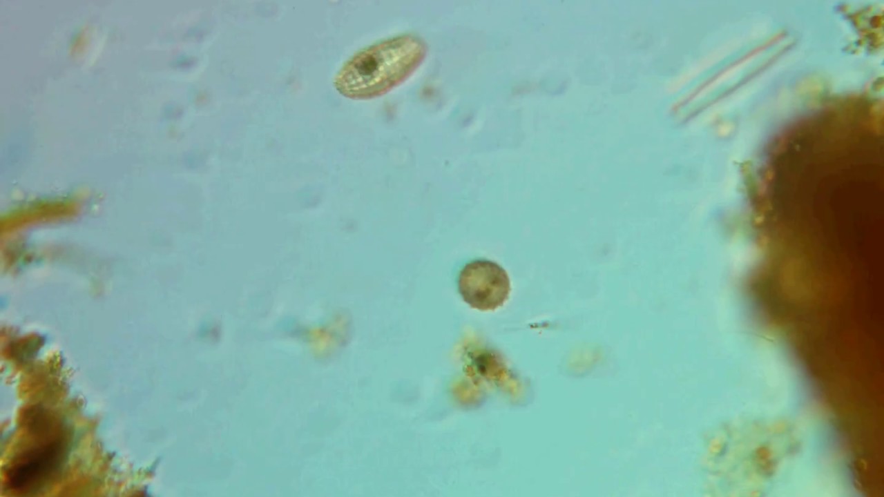 Armoured ciliate Coleps