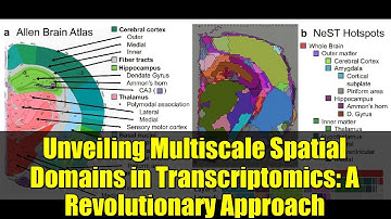 Unveiling Multiscale Spatial Domains in Transcriptomics: A Revolutionary Approach