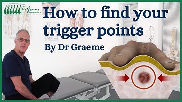 How to find trigger points