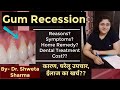 Gum Recession, Reason|Symptoms| Home Remedy|Treatment Cost?How To Identify the Receeding Gums?हिन्दी