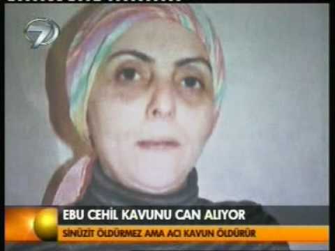 ACI KAVUN - Mustafa AYDINER