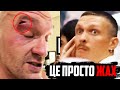 ❌БІЙ Усик vs Ф’юрі СКАСОВАНО! Ф’юрі отримав РОЗСІЧЕННЯ! Перший коментар британця!