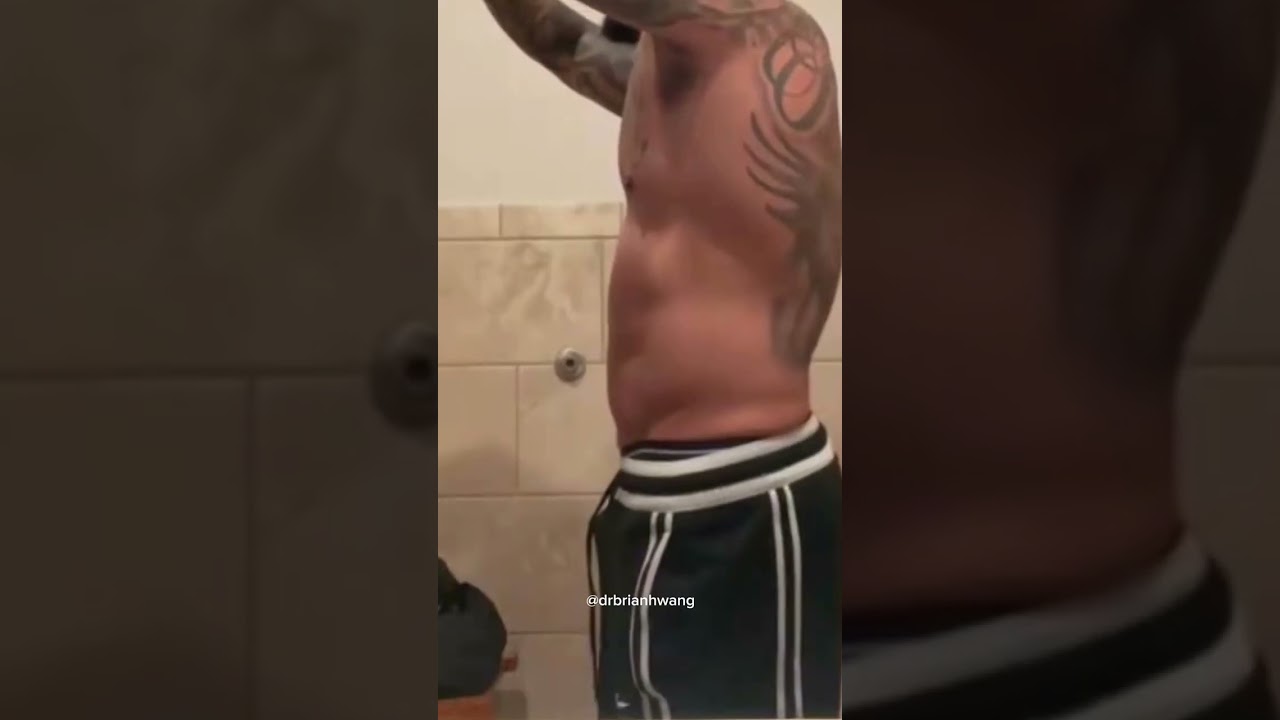 🔥 Male Patient Transformation 🔥