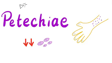 Per quale motivo vengono le petecchie?