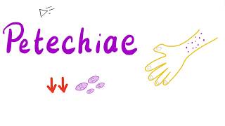 Petechiae | Subcutaneous Hematoma | Forensic Medicine