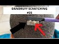Dandruff scratching #25