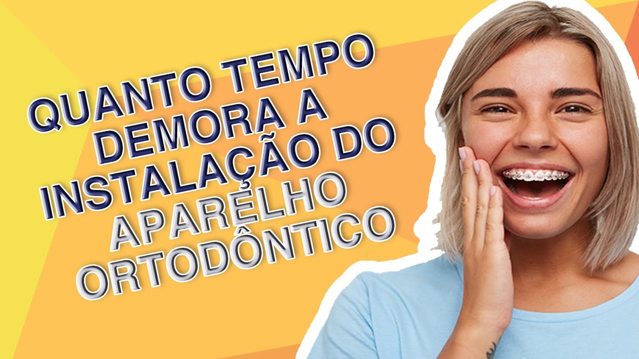 QUANTO TEMPO DEMORA A COLAGEM DO APARELHO ORTODÔNTICO | ASB TOTAL - YouTube